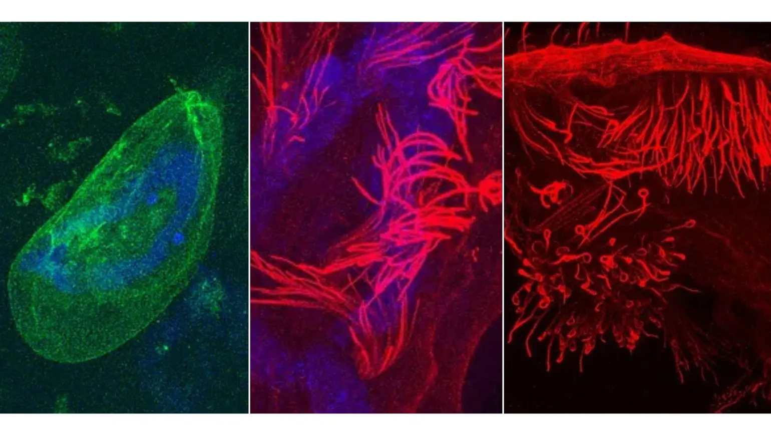 Examples of expansion microscopy imaging used to visualise Euplotes - another kind of single-celled organism. Credit: Hannah Laeverenz-Schlogelhofer + Kirsty Wan
